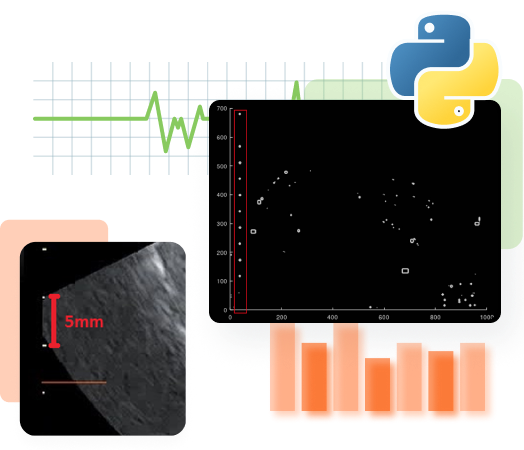project-ai-based-ultrasound-solution
